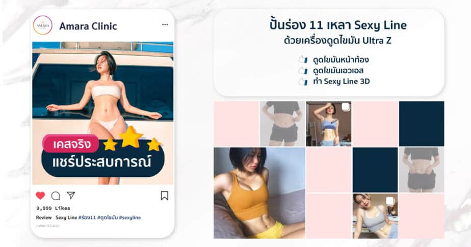 ดูดไขมัน sexy line