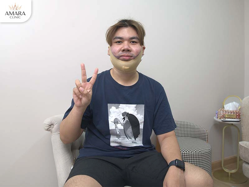Mr. Check convalesce after double chin liposuction